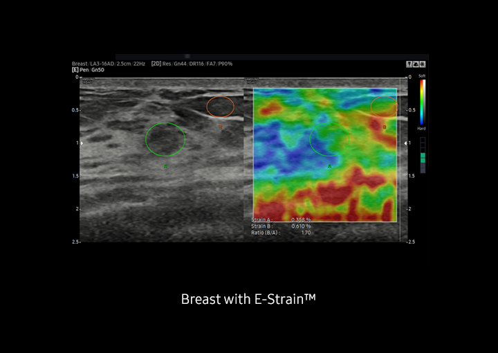 ElastoScan™Sample