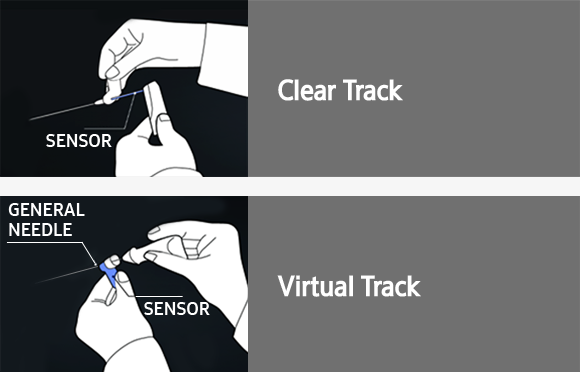 S-Tracking 