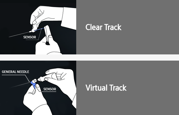 S-Tracking 