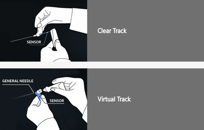 S-Tracking 