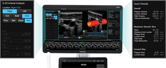 S-3D Arterial Analysis 