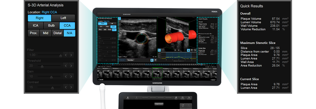 S-3D Arterial Analysis 
