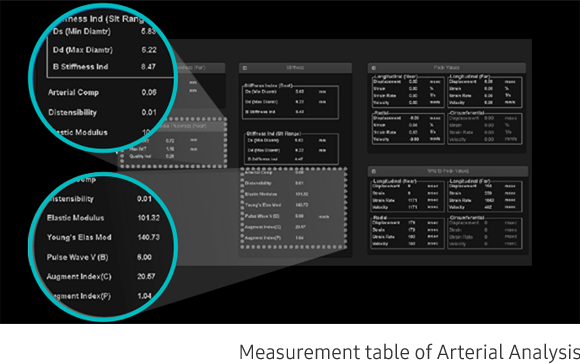 Arterial Analysis