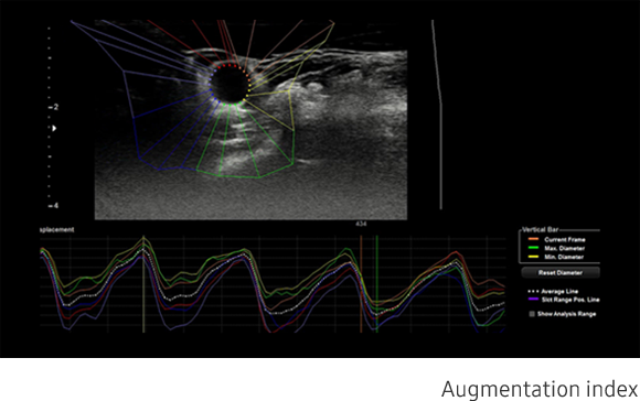 Arterial Analysis
