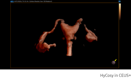 HyCosy in CEUS+
