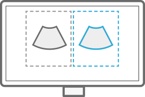 One-to-one comparison of past test results and current test results : EzCompare™