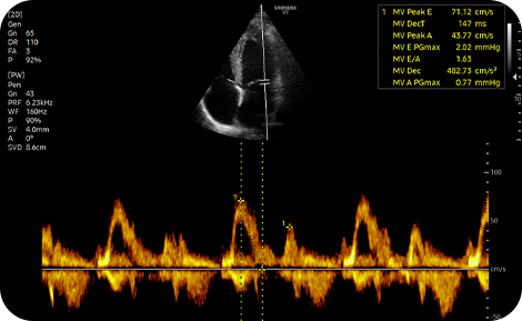 cardiac solutions : HeartAssist™