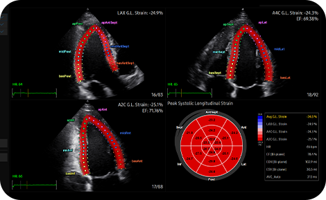 medical diagnostics : Strain+