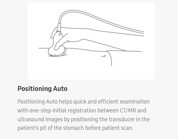 ultrasound transducer Positioning Auto