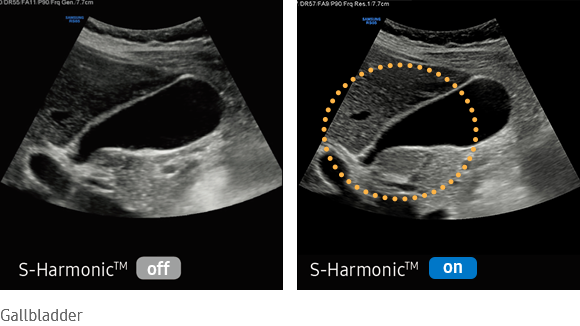 imaging solutions  : S-Harmonic™