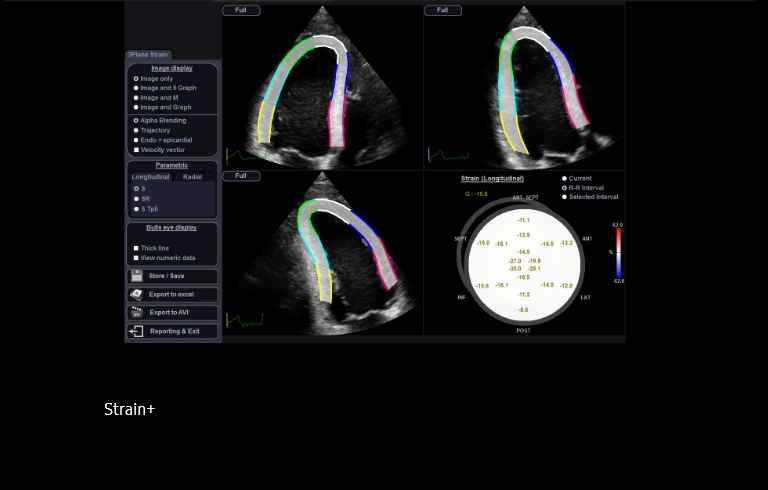 S-Detect™ for Thyroid™