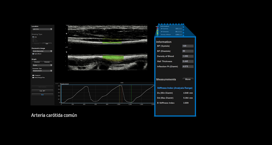 Arterial Analysis™