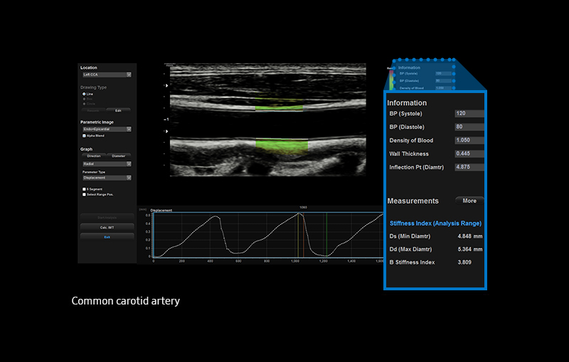 Arterial Analysis™