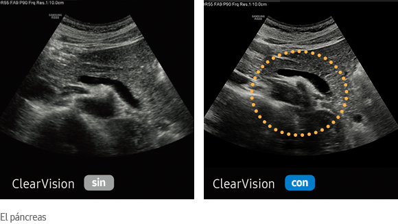 ClearVision