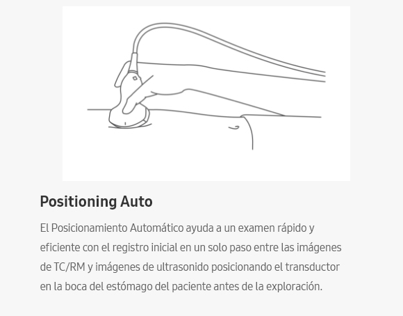 Posicionamiento automático, El Posicionamiento Automático ayuda a un examen rápido y eficiente con el registro inicial en un solo paso entre las imágenes de TC/RM y imágenes de ultrasonido posicionando el transductor en la boca del estómago del paciente antes de la exploración.