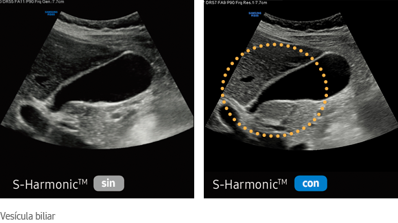 S-Harmonic™