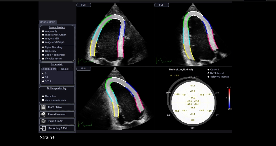 S-Detect™ for Thyroid™