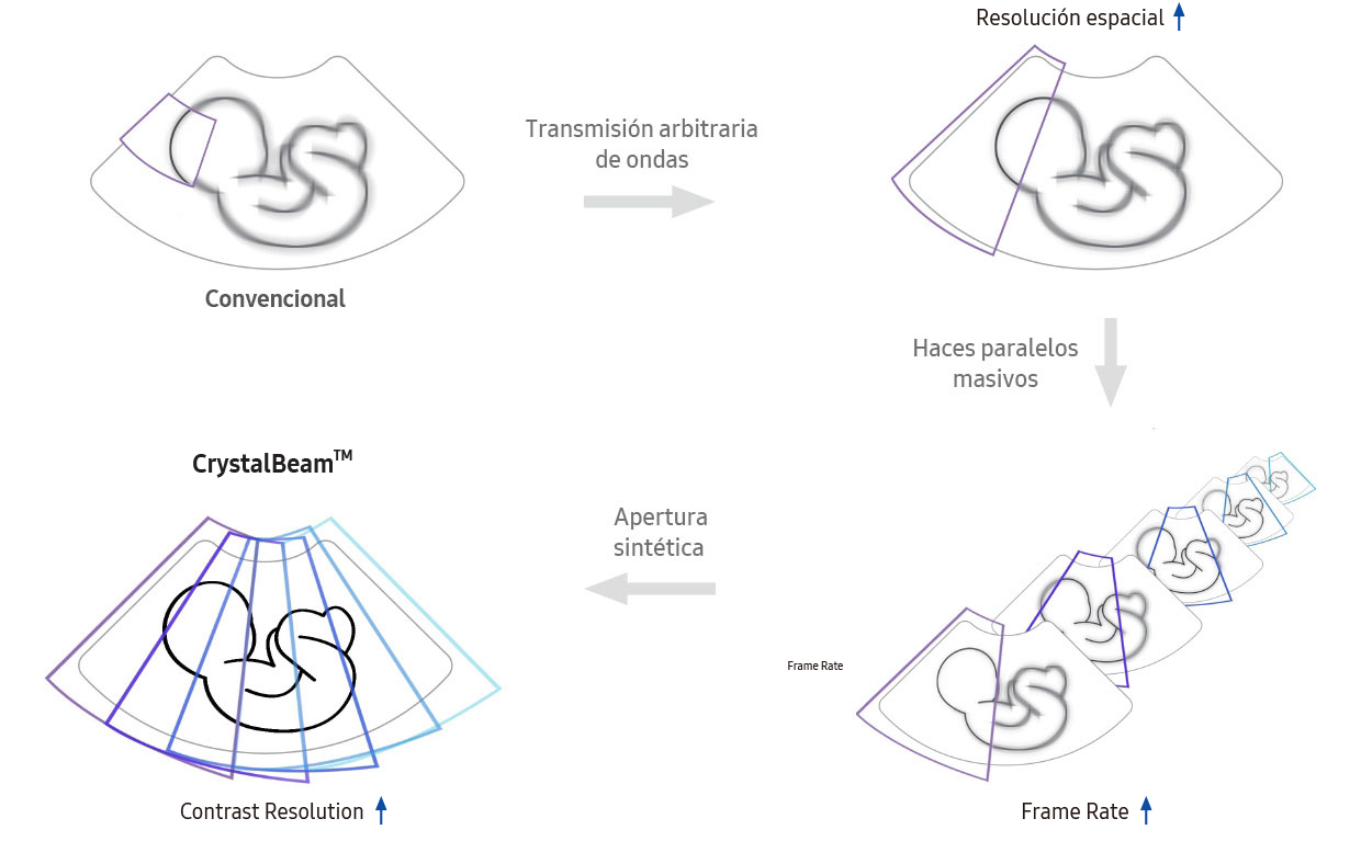 Convencional → Transmisión arbitraria de ondas → Resolución espacial ↑ → Haces paralelos masivos → Frame Rate ↑ → Apertura sintética → CrystalBeam™