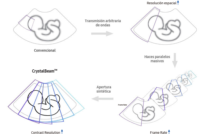 Convencional → Transmisión arbitraria de ondas → Resolución espacial ↑ → Haces paralelos masivos → Frame Rate ↑ → Apertura sintética → CrystalBeam™