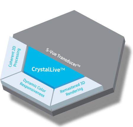 S-Vue Transducer™ - CrystalLive™ (Procesamiento 2D coherente, Respuesta dinámica de color, Rendimiento 3D remasterizado)