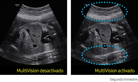 ClearVision™ Sample