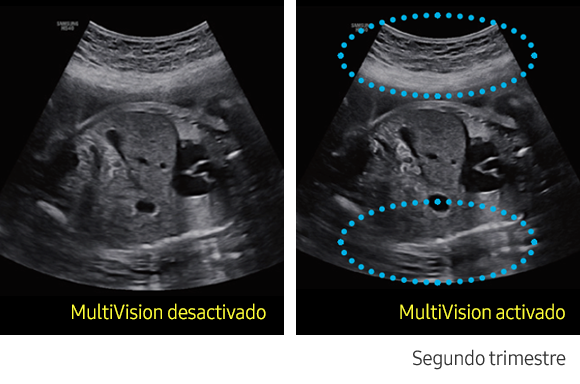 ClearVision™ Sample