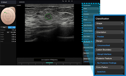 S-Detect™ for Breast