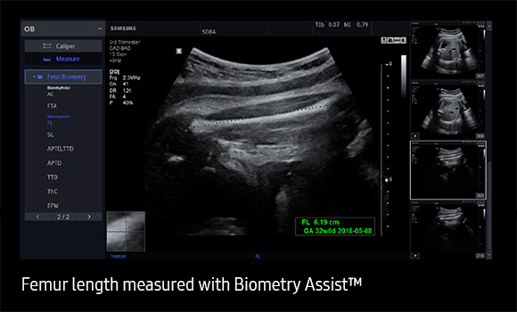 Biometry Assist™