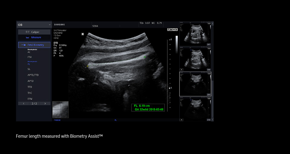 Biometry Assist™