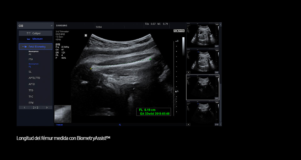 Biometry Assist™