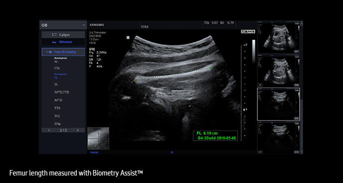 Biometry Assist™