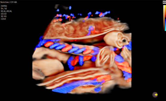 3d imaging : CrystalVue Flow™ 