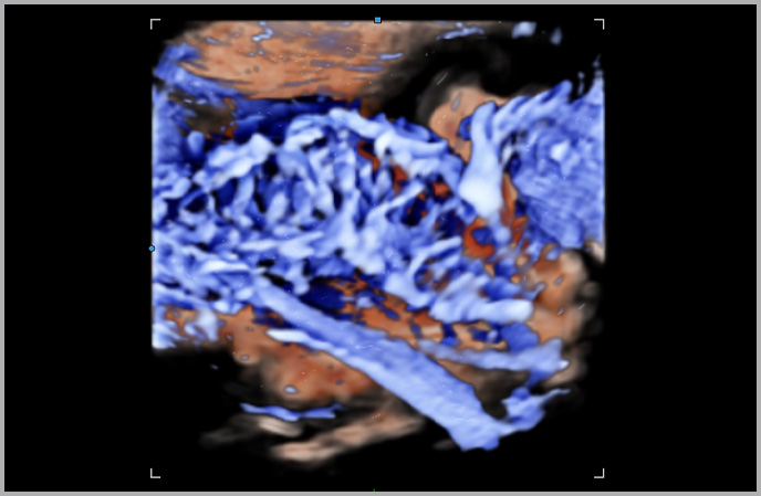 imaging solutions : S-Flow™ with LumiFlow™