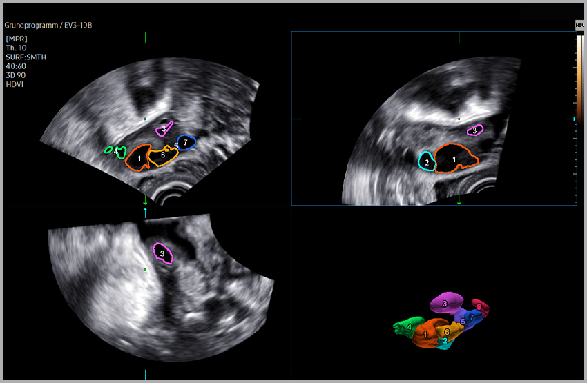 imaging solutions  : 5D Follicle™