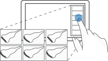 Select most common ultrasound transducer : QuickPreset 