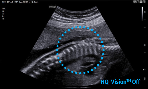 imaging solutions : HQ-Vision™ - off