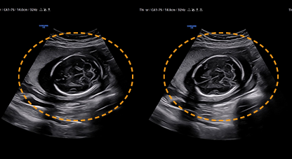 imaging solutions : ShadowHDR™