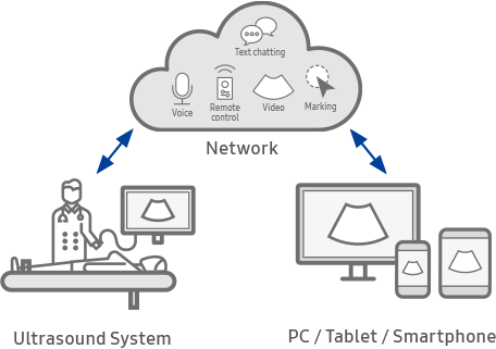 telesonography : SonoSync™ 