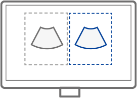 Compare ultrasound images : EzCompare™